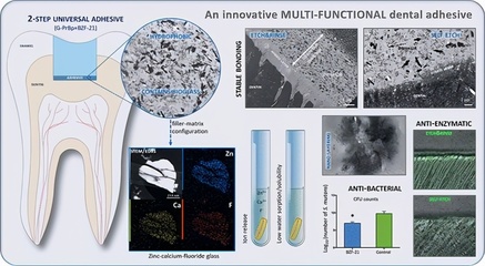 比利时卢汶大学《应用材料界面》锌-钙-氟化物生物玻璃基的''牙胶粘剂''